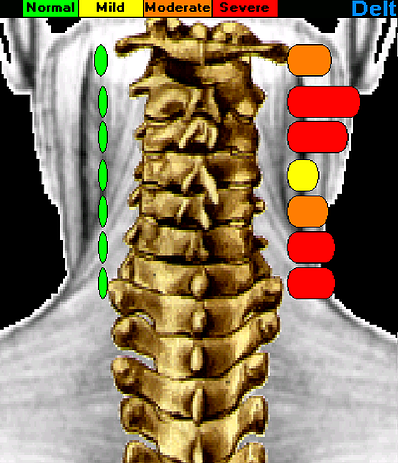 Thermography And Your Health Healthful Chiropractic